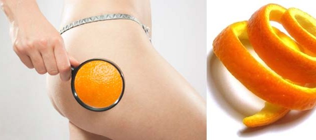 5 easy ways to get rid of cellulite